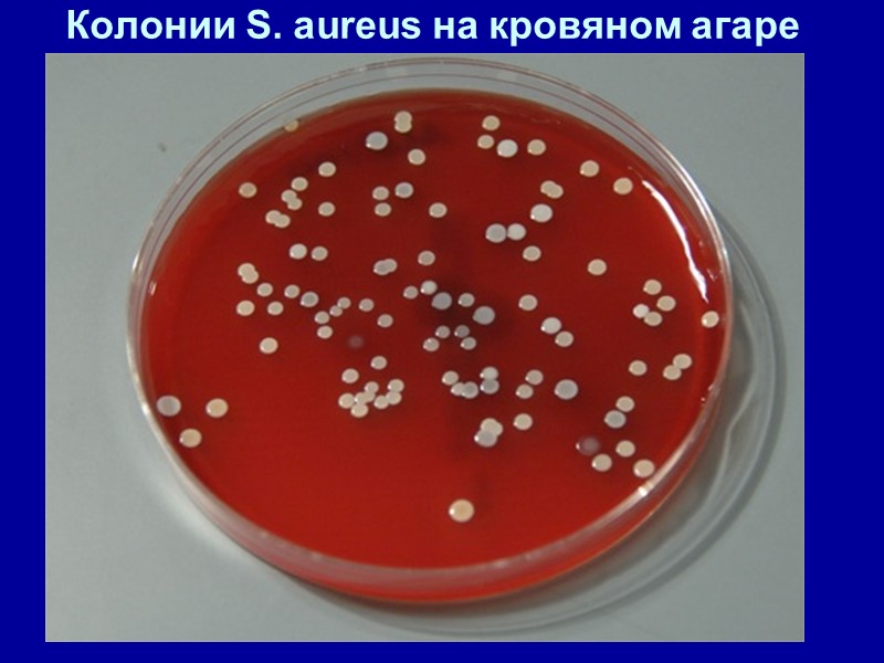 Колонии S. aureus на кровяном агаре